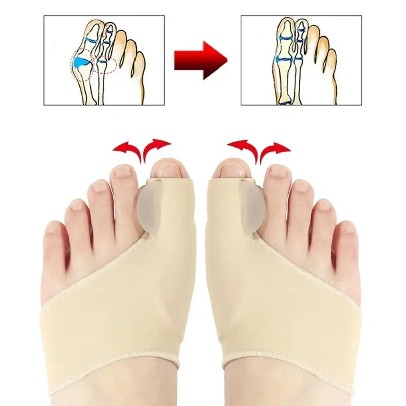 Hallux Valgus Bunion Corrector Toe Separator Set – Orthopaedic Foot Straightener Relief 2026