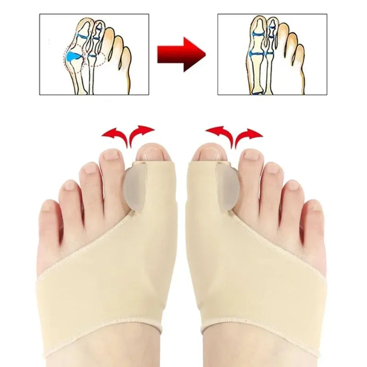 Hallux Valgus Bunion Corrector Toe Separator Set – Orthopaedic Foot Straightener Relief 2026