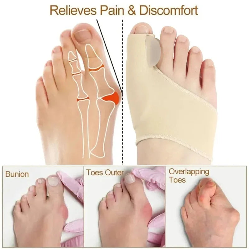 Hallux Valgus Bunion Corrector Toe Separator Set – Orthopaedic Foot Straightener Relief 2026