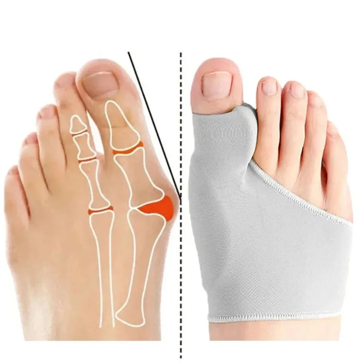 Hallux Valgus Bunion Corrector Toe Separator Set – Orthopaedic Foot Straightener Relief 2026
